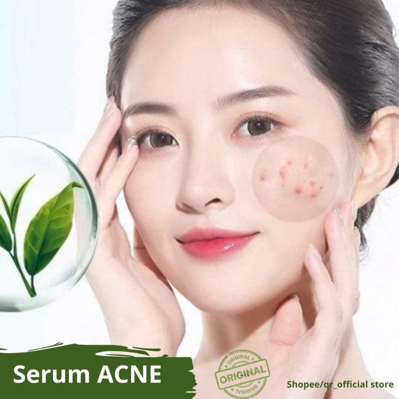 SERUM ACNE ORIGINAL/SERUM JERAWAT AMPUH/SERUM WHITENING ACNE