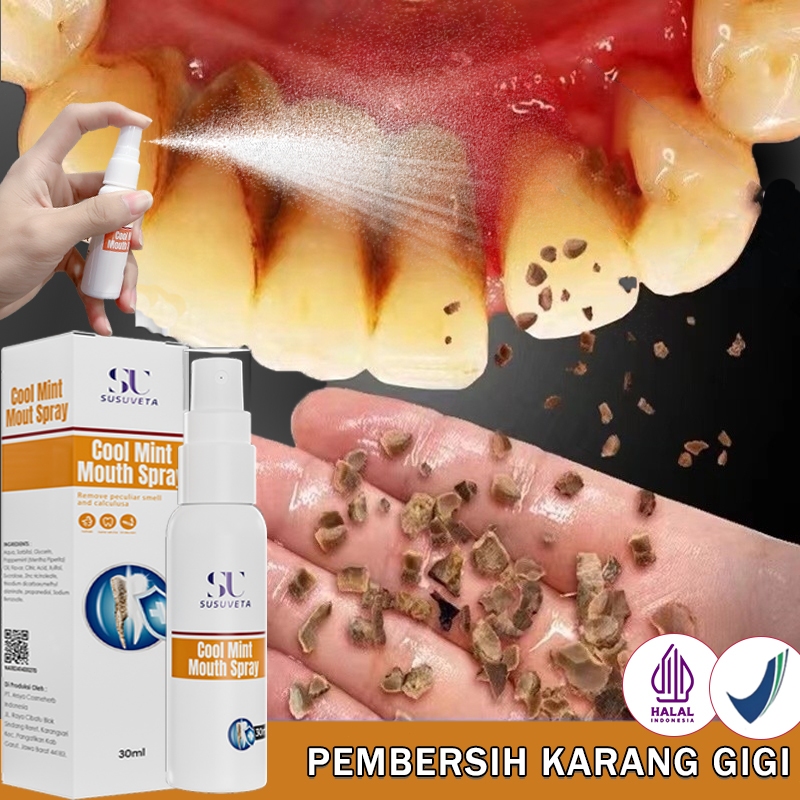 Penghilang karang gigi membandel perontok karang gigi paling ampuh pembersih gigi kuning dan karang 