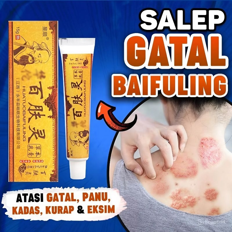 Salep Original Psoriasis Eksim Jamur Kurap Alergi Kulit Cream Cina Obat Gatal bayi Anak-Anak balita 
