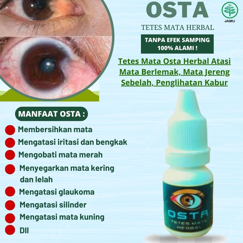 OSTA Obat Tetes Mata Paling Ampuh - Mengatasi Mata Berlemak, Mata Jereng Sebelah, Penglihatan Kabur