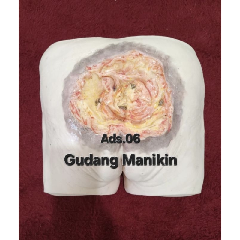 Phantom Manikin Ulkus Dekubitus / bokong / Pantat Deskubitus Simulator Manikin Luka