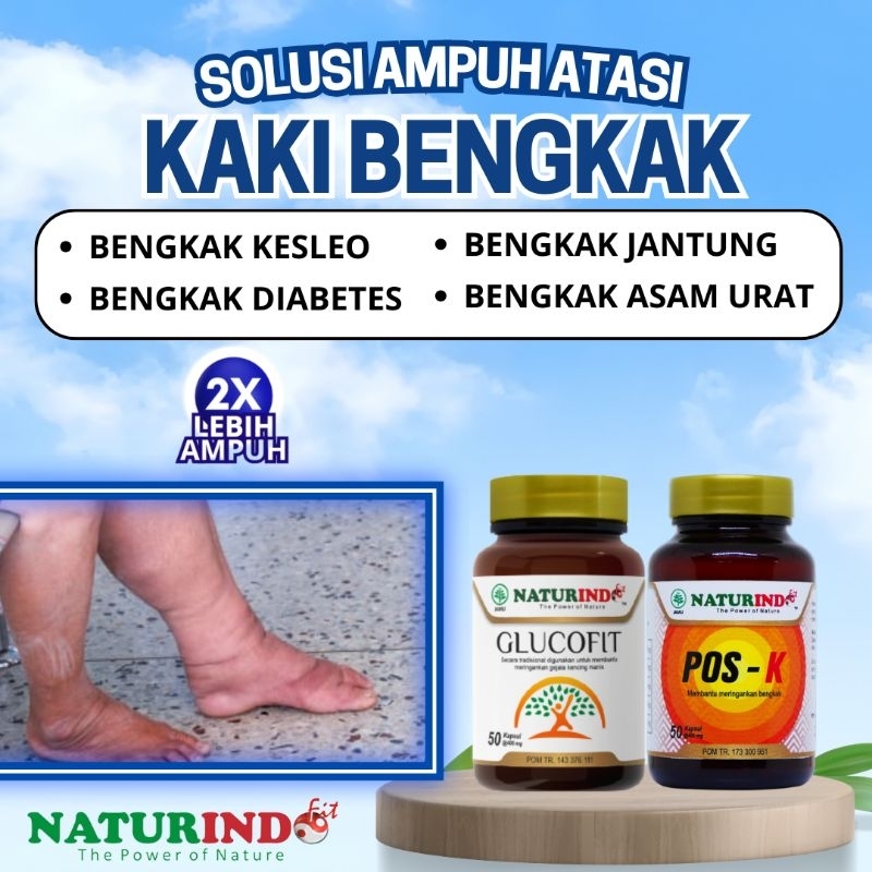 Obat kaki Bengkak Diabetes Bengkak Kesleo Pecah Pecah Paling Ampuh