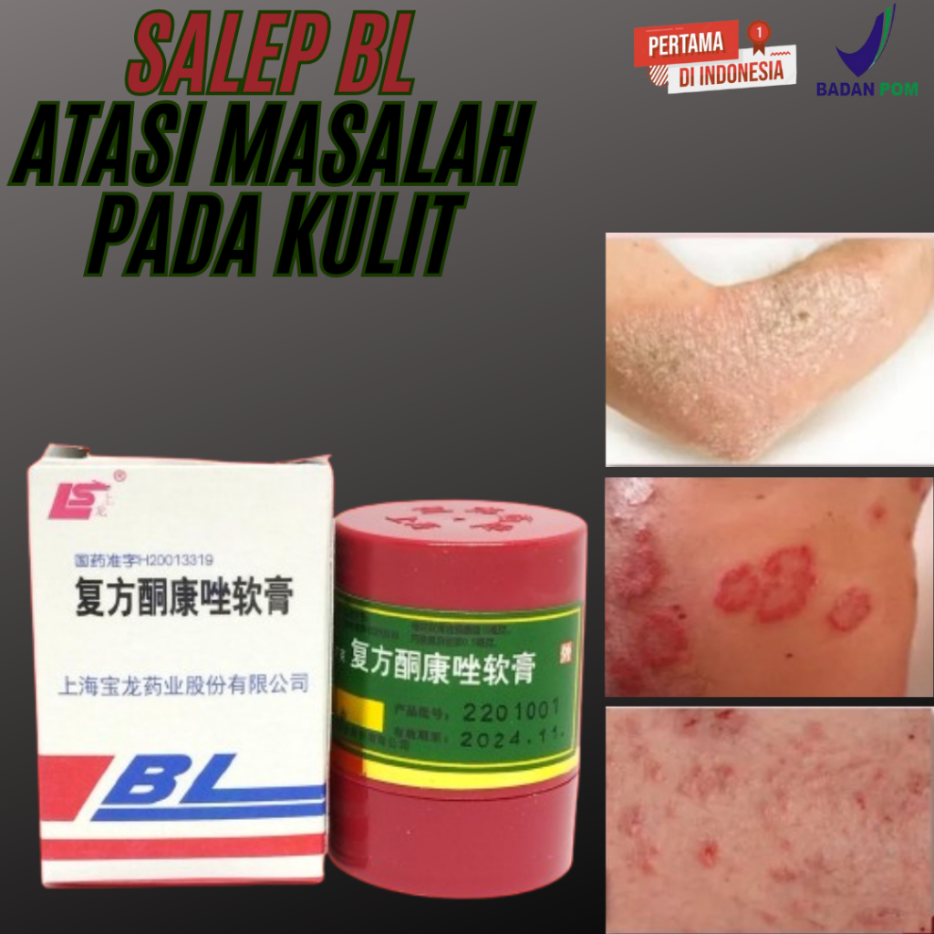 (JUAL) SALEP BL ORIGINAL salep asli atasi gatel kutu air eksim panu kurap