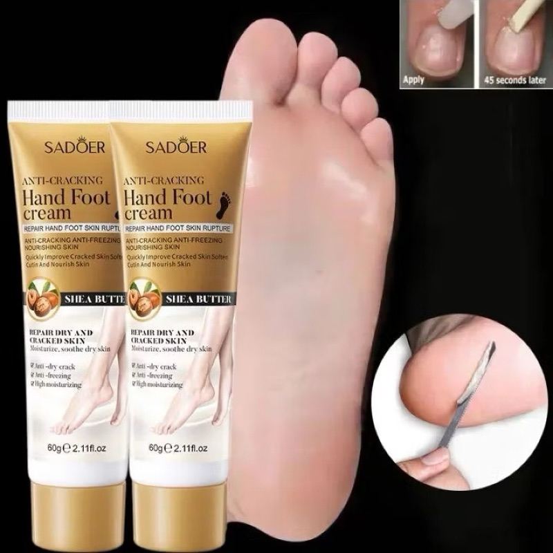 repair hand foot skin/ Sadoer Anti-Cracking Hand Foot Cream