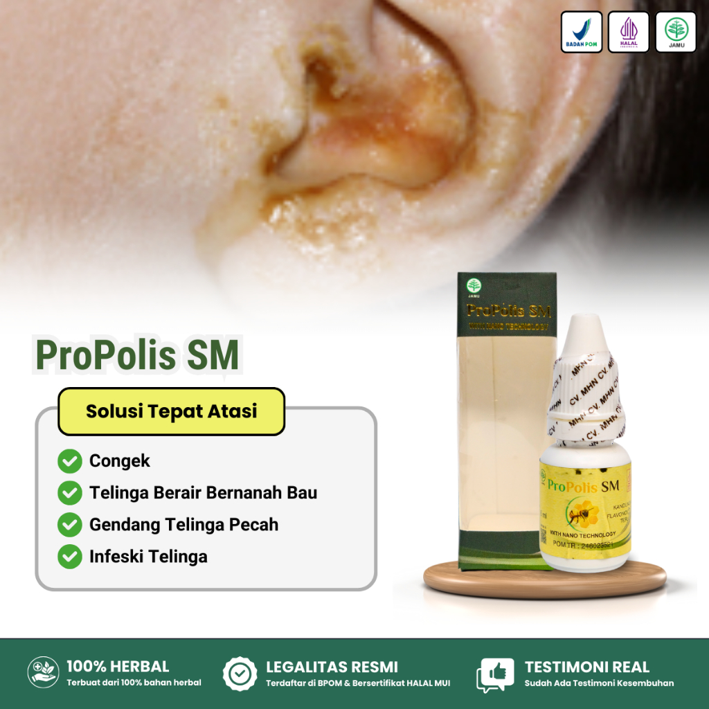 Obat Congek Telinga Bernanah Bau Busuk, Obat Telinga Berair, Obat Telinga Budeg, Obat Pembersih Teli