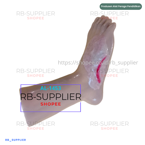 MANIKIN MODEL KAKI LUKA EPITHELISASI | ALAT PERAGA PANTOM MANEKIN JENIS LUKA PADA KAKI