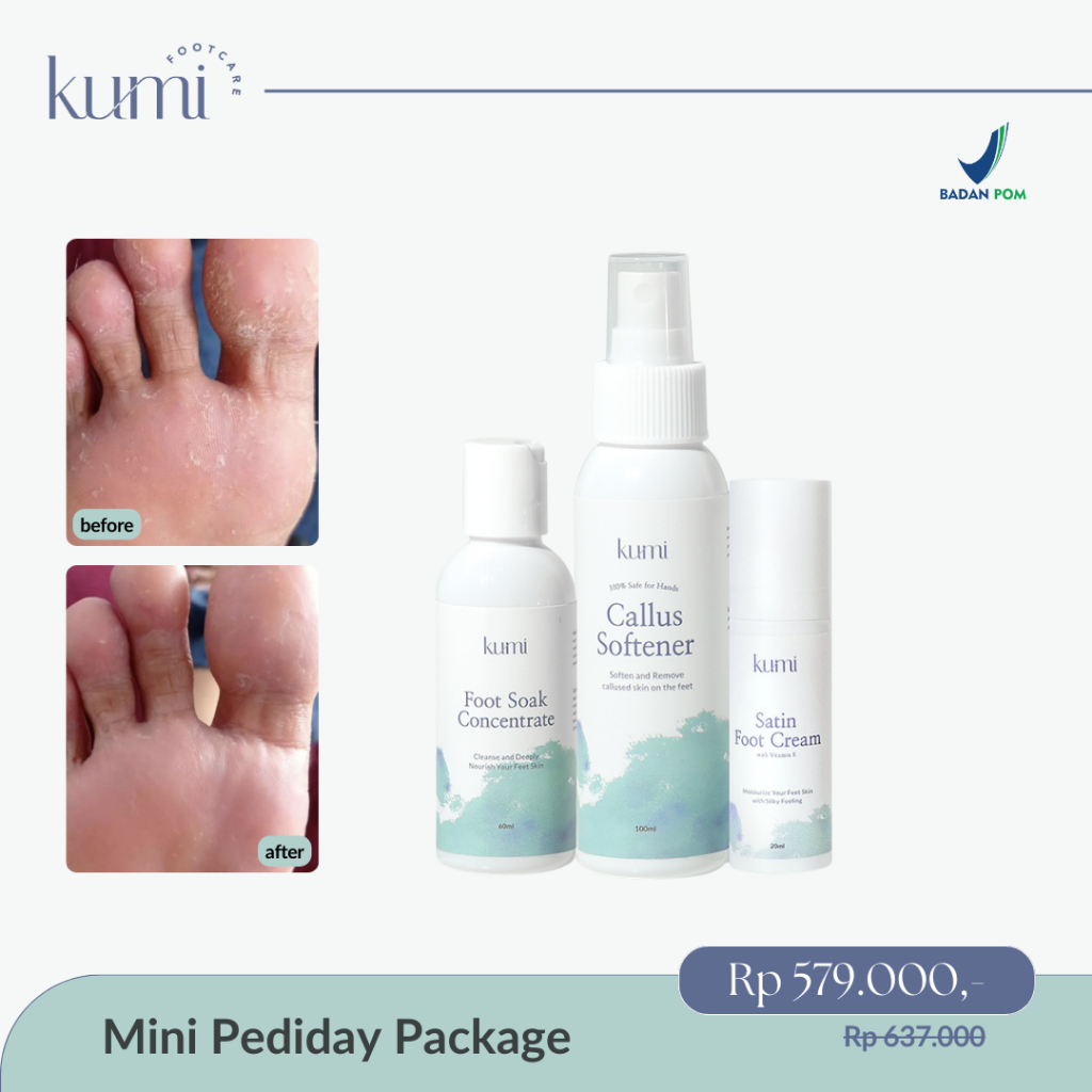 Kumi PEDIDAY PACKAGE/ Pedicure / Callus Treatment / Footcare / Kapalan / Treatment Kaki