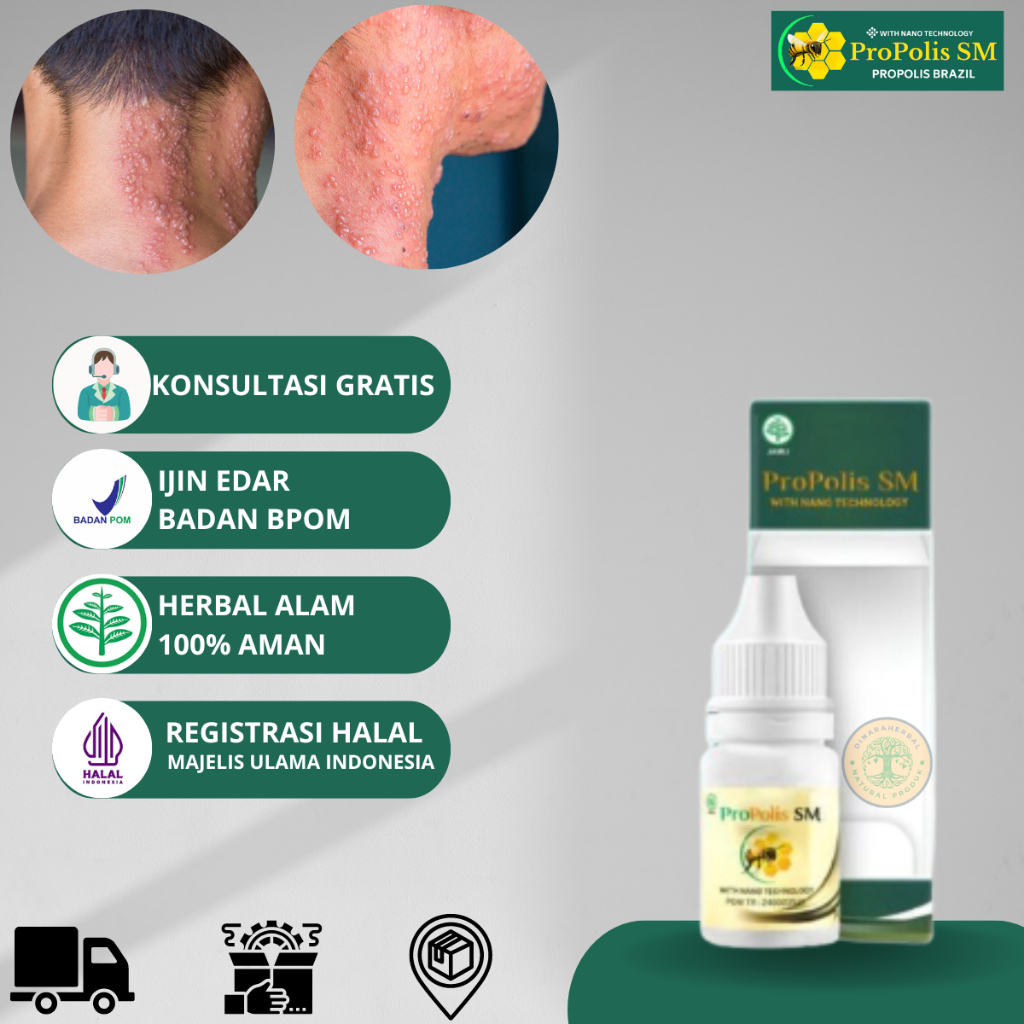 Obat Herpes Zoster, Obat Herpes kulit, Obat herpes bibir, Obat herpes Genital / Herpes Kelamin, Sale