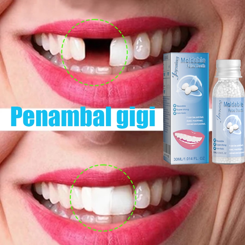Gigi palsu Tambal gigi Penambal gigi berlubang Tambal gigi permanen Gigi palsu asli dokter Penambal 