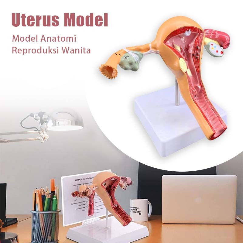 Model Anatomy Patologis Uterus Ovarium Manekin Rahim Uterus Ovary Anatomical Utk Pelajaran Fisiologi