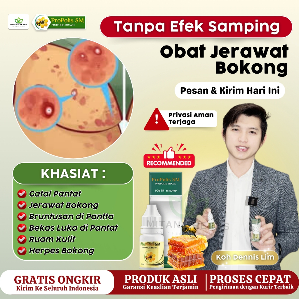 Obat Oles Cair Jerawat Bokong, Obat Gatal Pantat, Obat Pantat Bruntusan, Jerawat Bokong,  Obat Panta
