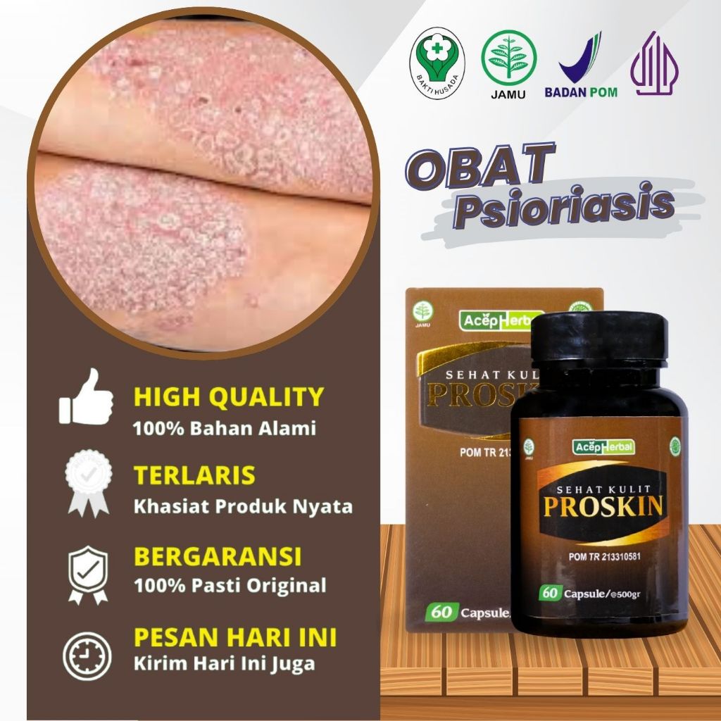 Obat Psioriasis, Gatal Kulit Psoriasis, Obat Kulit Bersisik Di Siku, Tangan, Lutut, Kulit Bersisik D