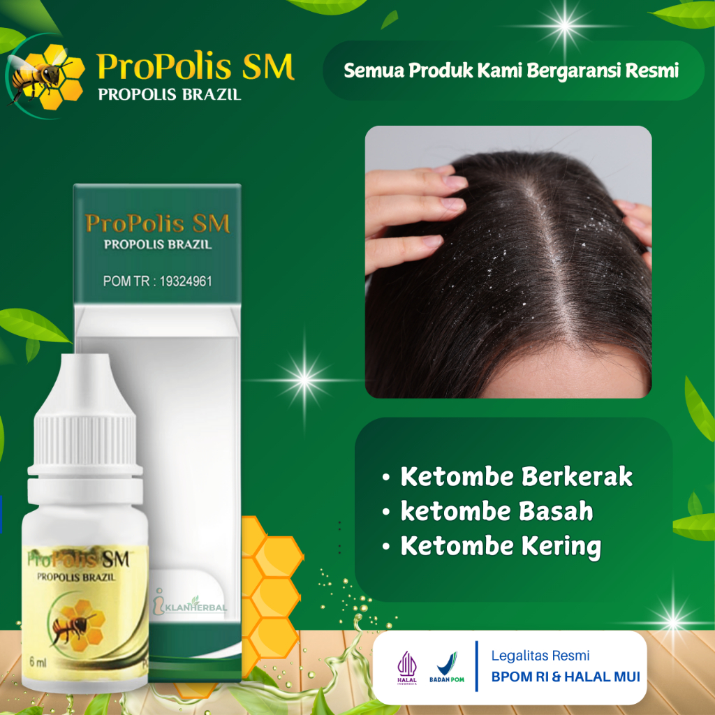 Obat Penghilang Ketombe Berkerak, Ketombe Basah, Ketombe kering Untuk Anak Dewasa - Propolis SM