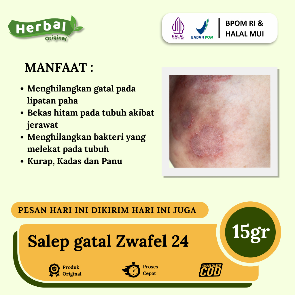 Salep 2-4 Zwafel Obat Gatal ORIGINAL BPOM Multifungsi Mengandung Belerang Isi 10gr