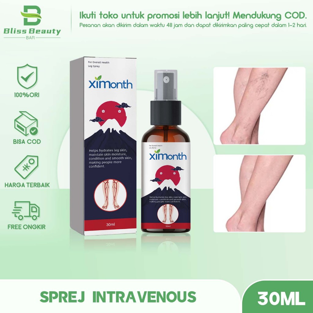 Ximonth Varicose Veins Spray 30ml Obat Varises Leg Spray Semprotan Varises Salep Varises