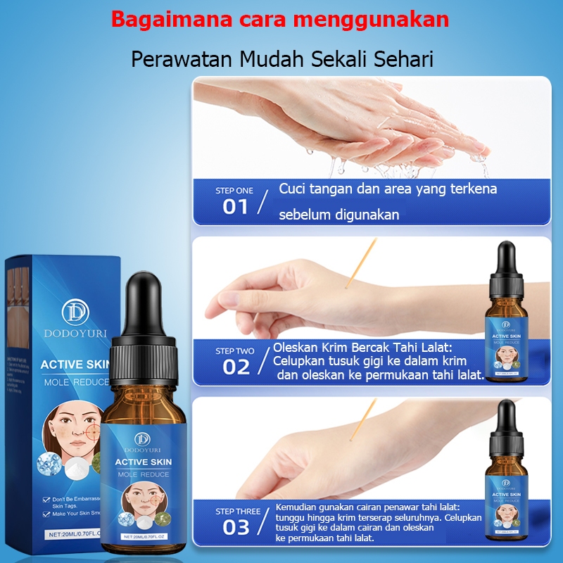 Penghilang tahi lalat penghilang tahi lalat di wajah obat penghilang tahi lalat penghilang tailat