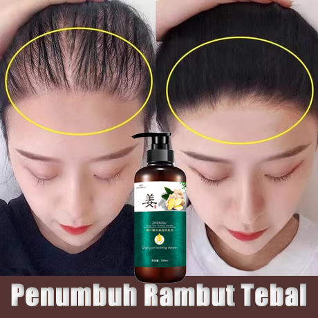 natur shampoo rambut rontok sampo penumbuh rambut cepat penebal rambut gatal menyegarkan sampho ramb