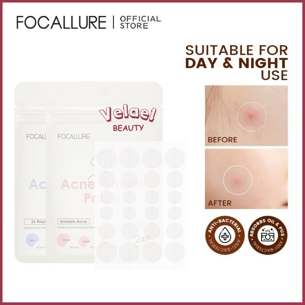 FOCALLURE || focallure Spot Patch Acne Treatment Day/Night | Acne Patch
