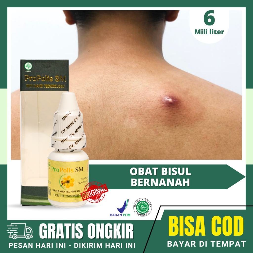 Obat Bisul, Bisul Dipunggung, Bisul Bernanah, Salep Bisul, Bisul Di Ketiak, Kepala  PROPOLIS SM