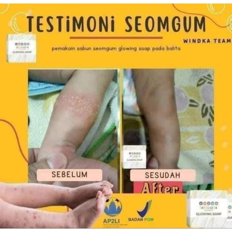 seom gum paket reseller