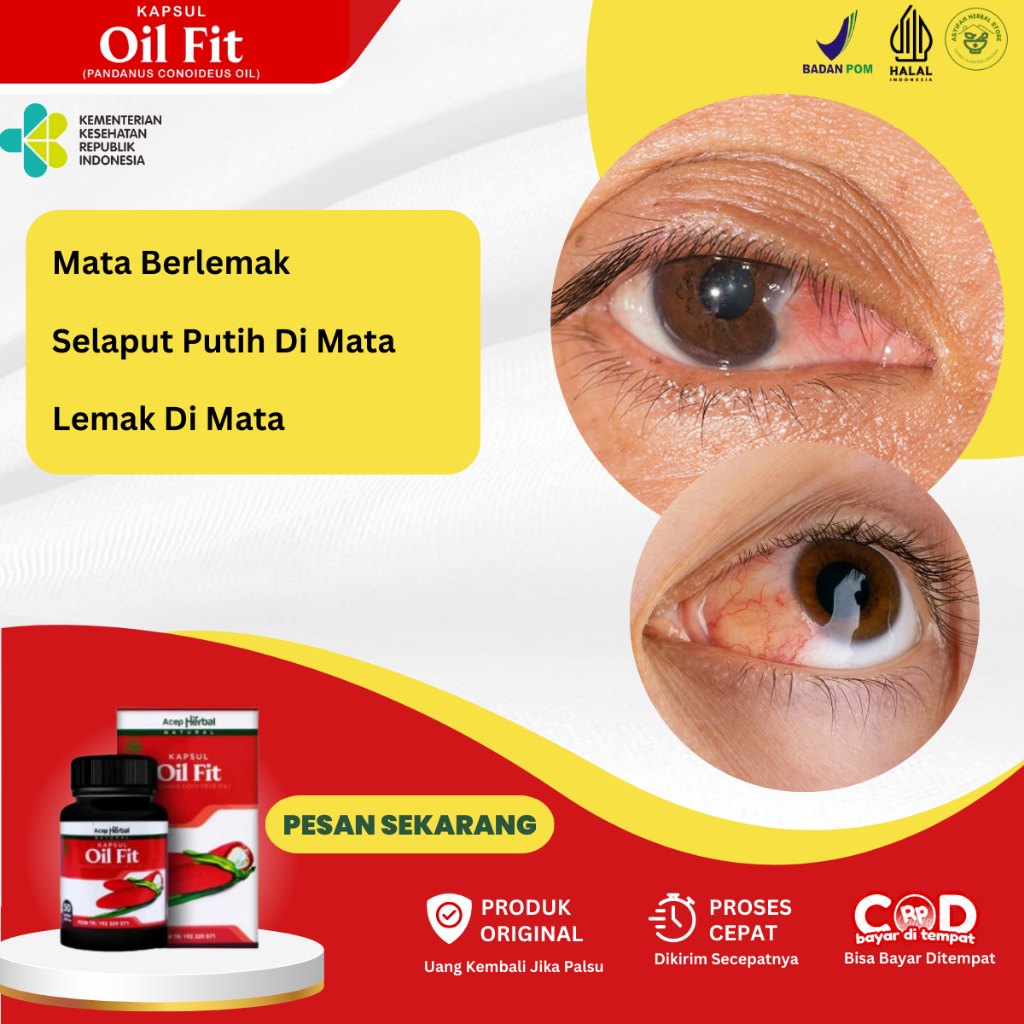 Obat Mata Berlemak, Obat Penghilang Mata Berlemak, Obat Mata Pterigium, Obat MAta Rabun, Obat Penyak