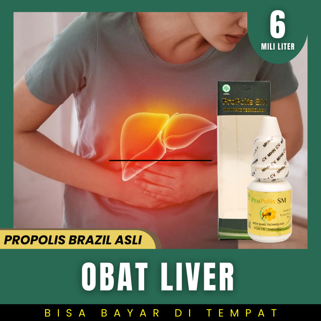 Obat Hepatitis Liver Gangguan Fungsi Hati Sirosis Hati Penyakit Kuning | PROPOLIS SM BRAZIL