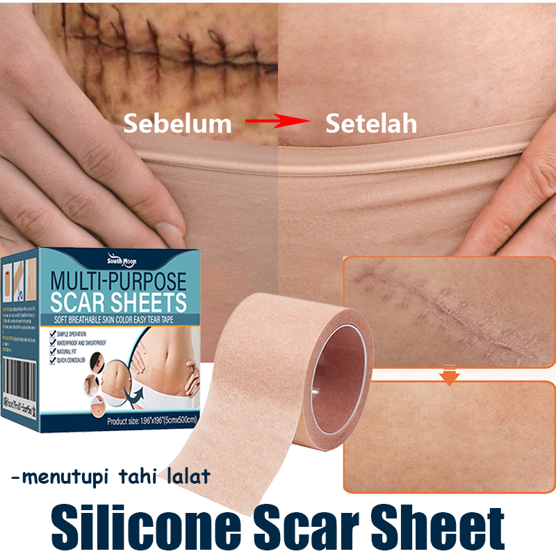 Silicone Scar Sheet Penghilang Bekas Luka Tambalan Concealer  Penutup Tattoo Stiker Penutup Bekas Lu