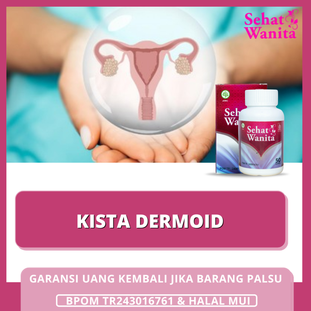 Obat Kista Dermoid, Obat Penghancur Kista Dermoid, Obat Kista, Obat Tumor Kista | SEHAT WANITA