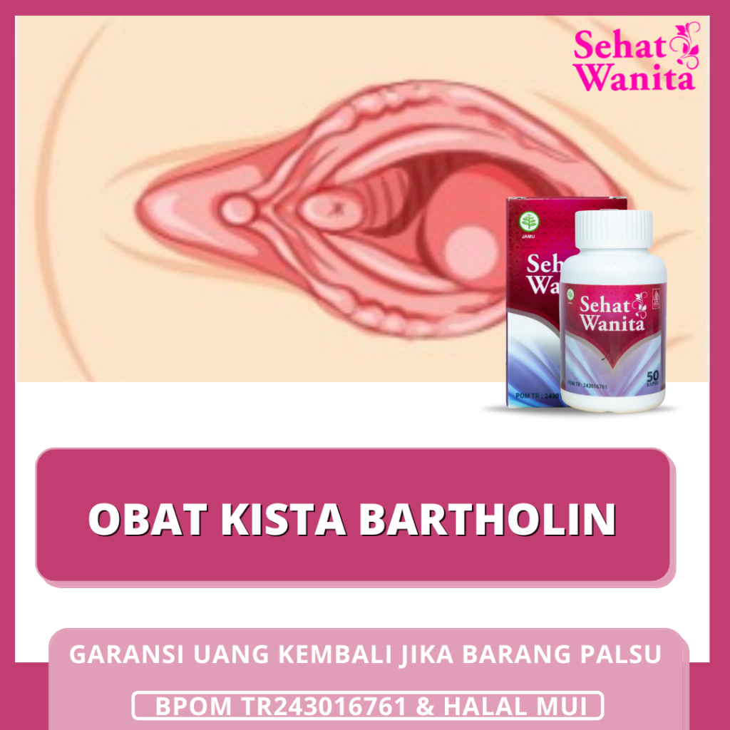 Obat Kista Bartholin, Kelenjar Bartholin, Obat Kista, Obat Penghancur Kelenjar Kista | SEHAT WANITA