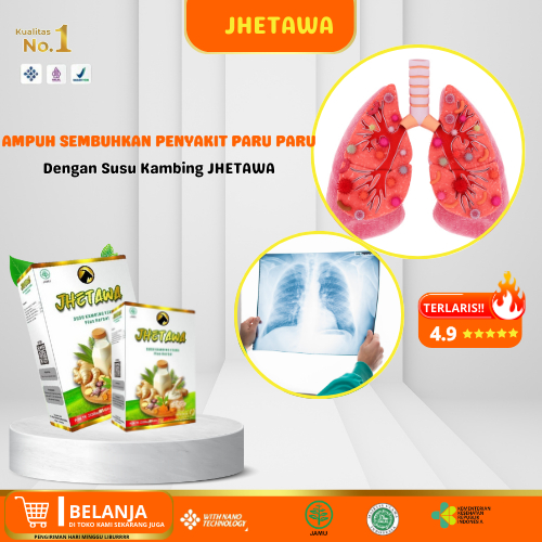 

Obat Paru Paru Sesak Nafas dan Batuk Untuk Anak Dewasa Jhetawa Susu Kambing Etawa Murni BPOM