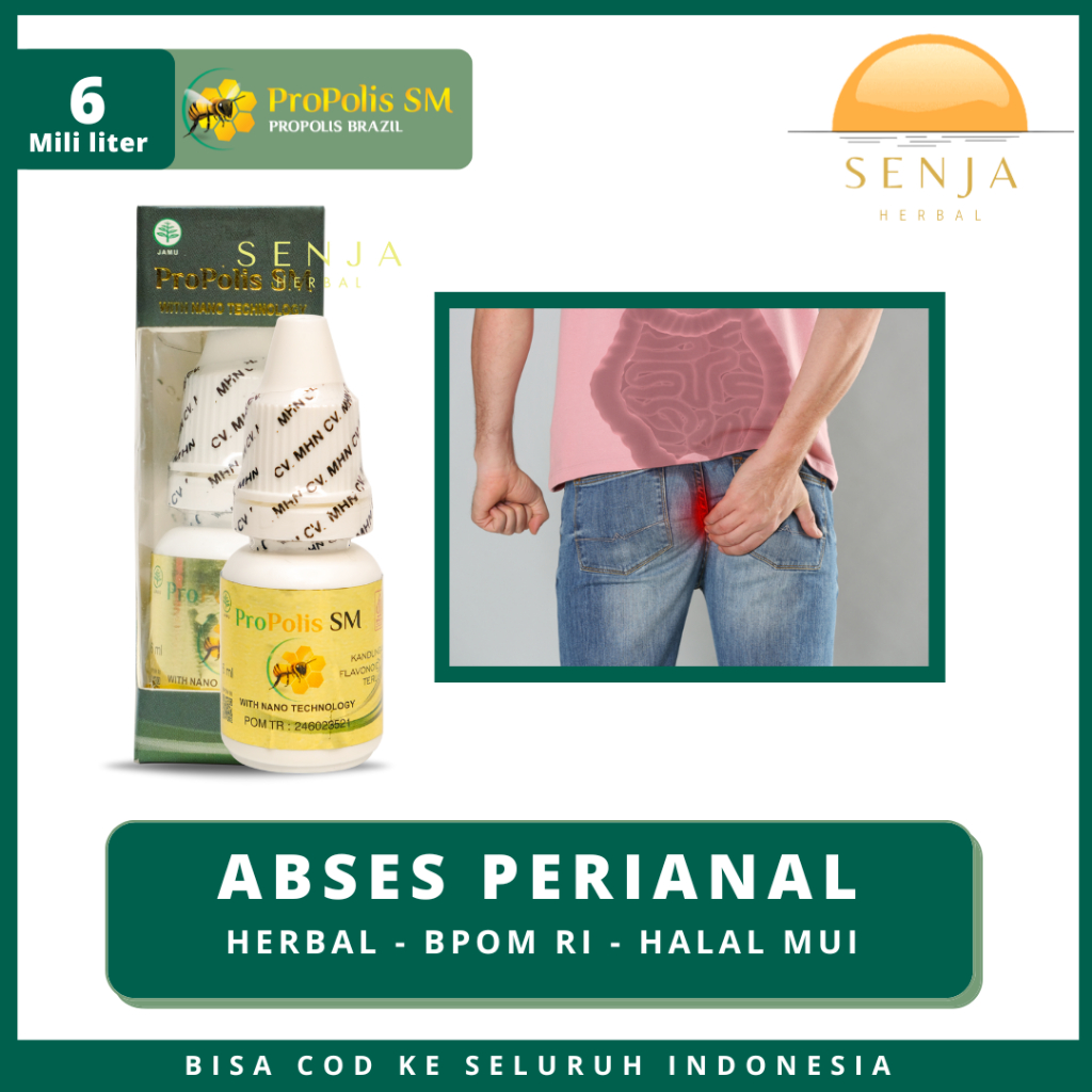 Obat Abses Anus, Fistula Ani, Radang Abses Anus Berdarah, Propolis SM Brazilian 100%