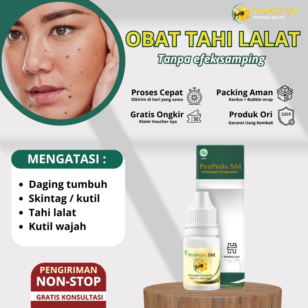 Penghilang Tahi Lalat di Wajah Penghilang Tahi Lalat Yang Lembut Dengan Formula Herbal Untuk Memperb