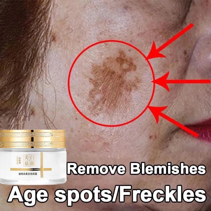 Krim penghilang flek hitam Cream penghilang flek hitam Cream flek hitam membandel 50g menghilangkan 