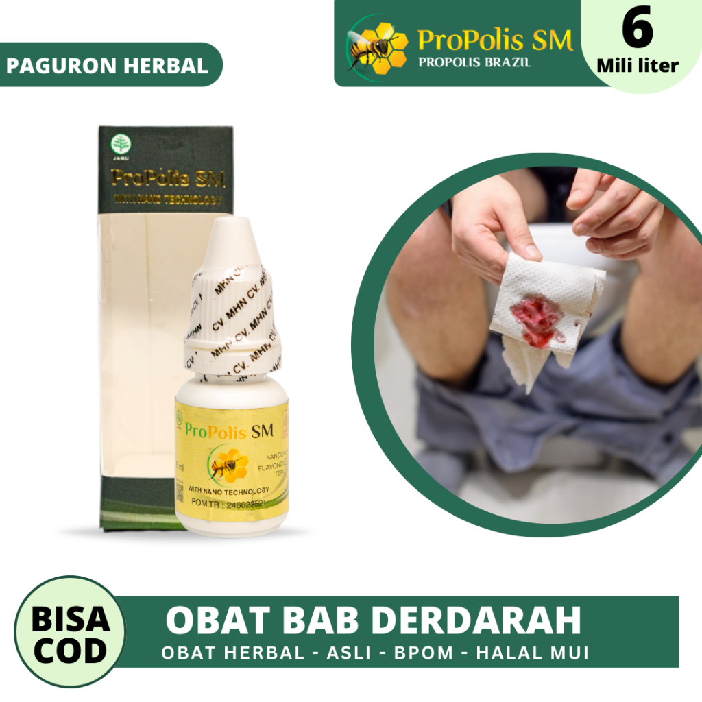 Obat BAB Berdarah, Wasir, Ambeien, Fistula Ani, Benjolan di Anus Bernanah - PROPOLIS SM BRAZIL