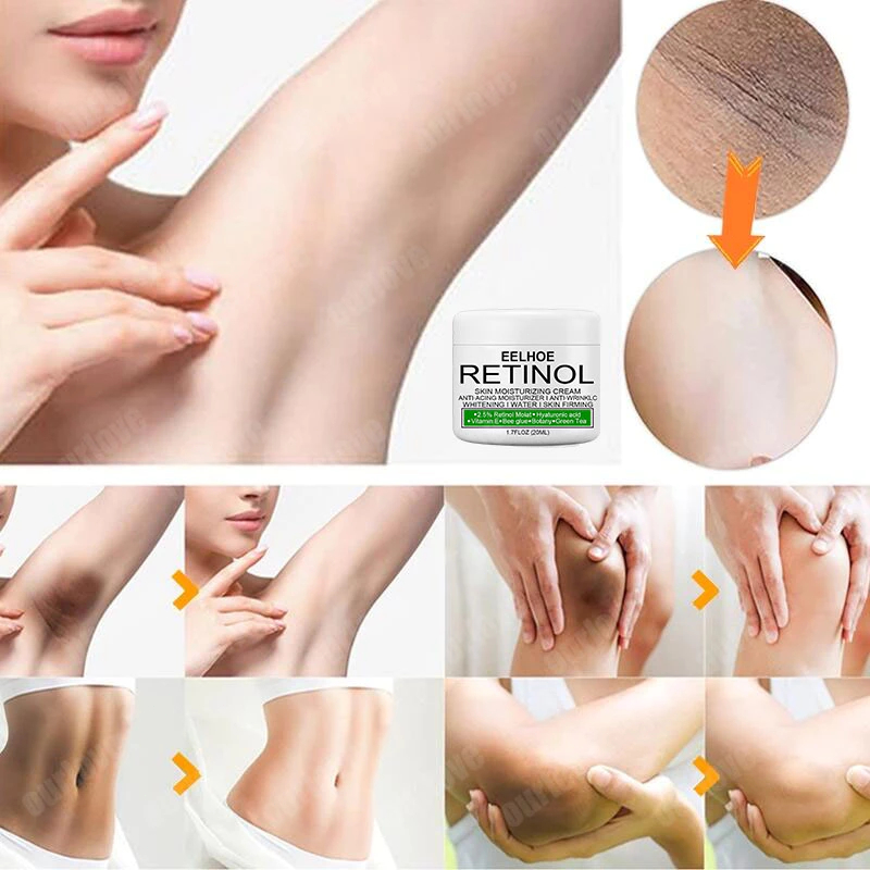 Krim Pemutih Ketiak Pemutihan Selangkangan Vagina Ketiak/Pantat/leher/siku/lutut krim pemutih melani