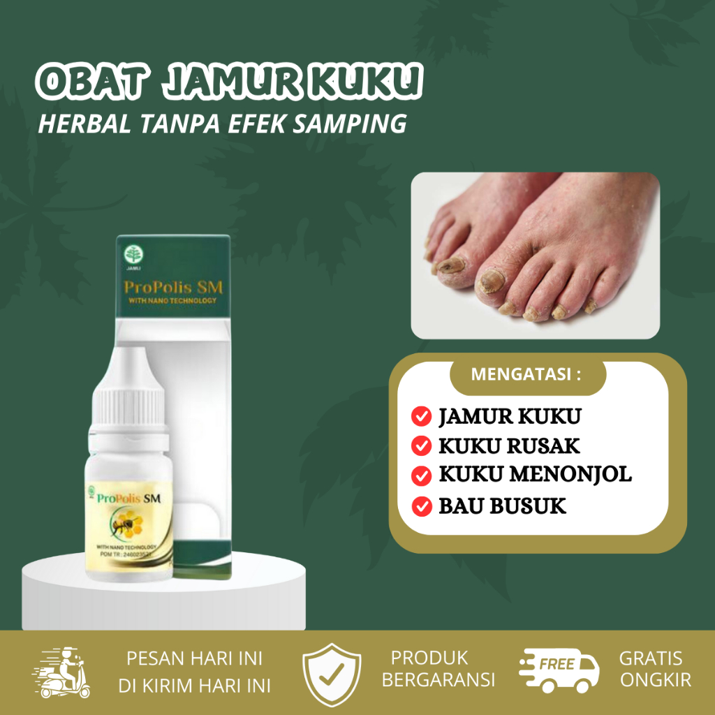 Obat Jamur Kuku, Kuku Jamur Rusak, Penghilang Jamur Kuku, Obat Jamur Kuku Kaki