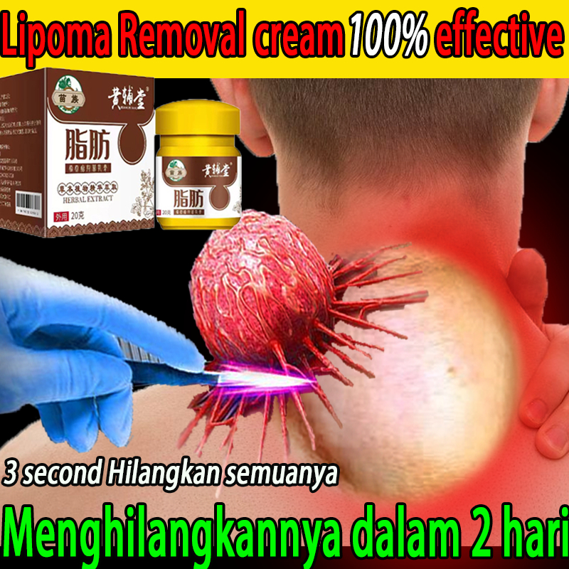 Lipoma Cream  salep lipoma Obat Benjolan Lipoma obat benjolan payudara Penghilang Lemak removal Benj