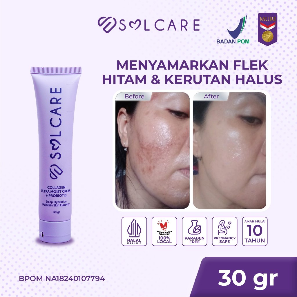 BELI 1 DAPAT 10 Solcare Collagen Ultra Moist Cream + Probiotic – Cream Penghilang Flek