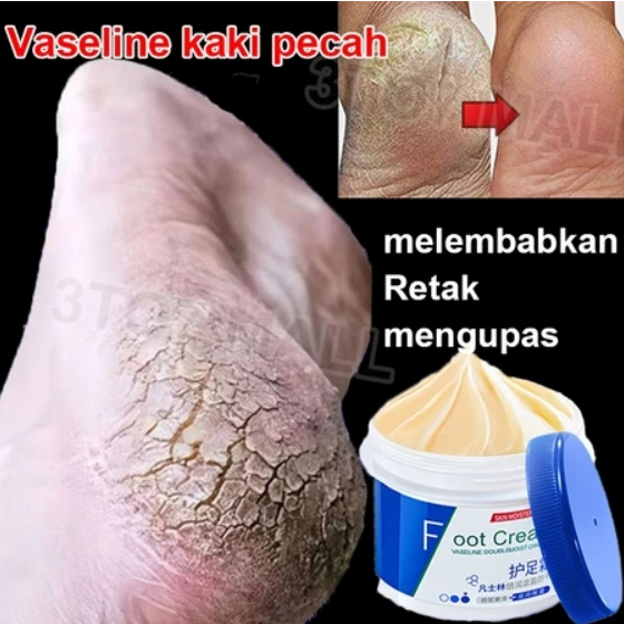 Vaseline kaki pecah dan kering Foot cream Obat kaki pecah Pelembab kaki kering dan pecah Penghalus k