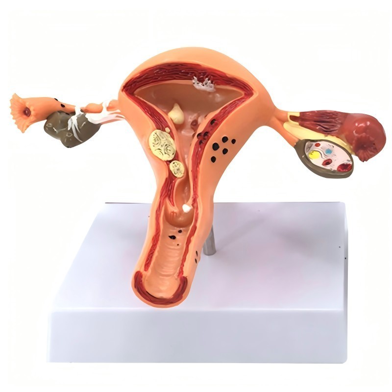 1Set Uterus Anatomical Model Patologis Uterus Ovarium Alat Peraga Uterus Uterus Ovary Anatomical