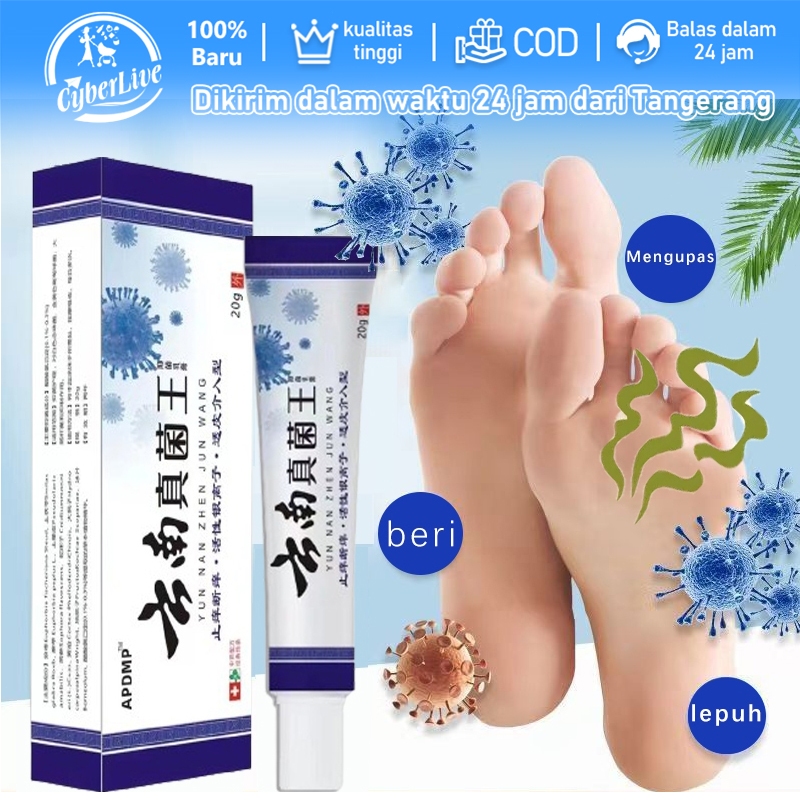 Obat Kaki Rayapan Dan Bau Penghilang Bau Kaki Obat Jamur Kaki Obat Kaki Jamuran Pembersih Kulit Mati