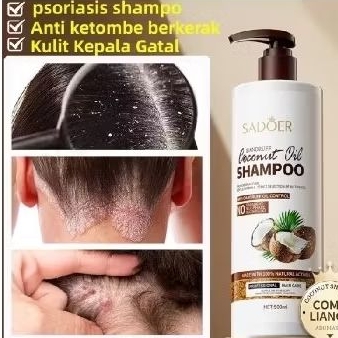 Shampo sadoer shampo anti ketombe, shampo ketombe 500ml