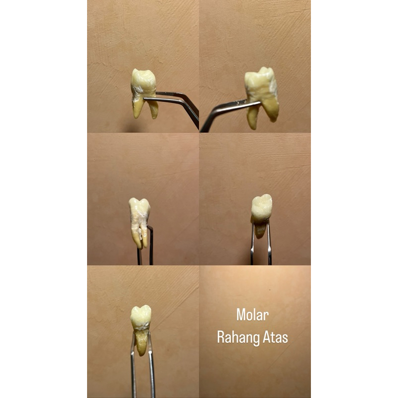 Jual Gigi Asli untuk Praktikum/ Gigi Molar