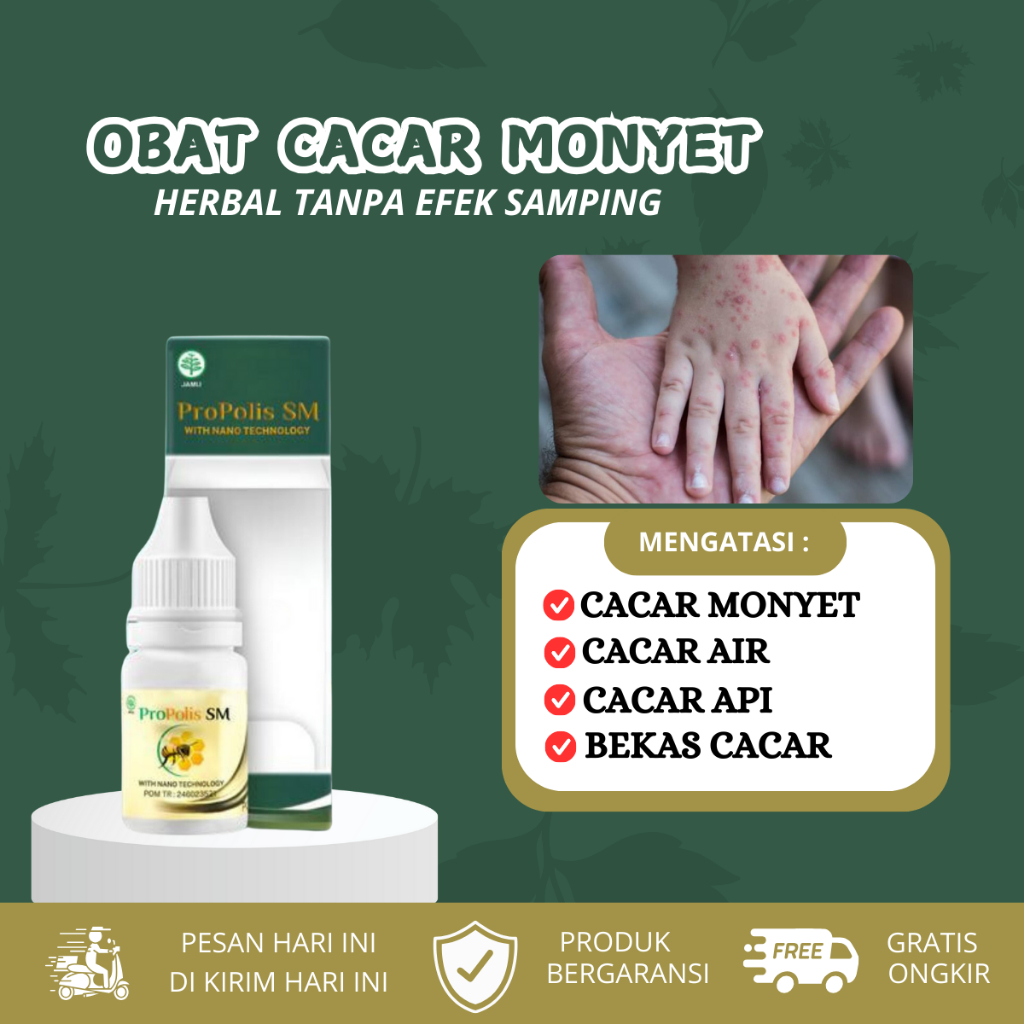 Obat Cacar Monyet, Monkeypox, Cacar Air, Cacar Api, Cacar di Seluruh Tubuh