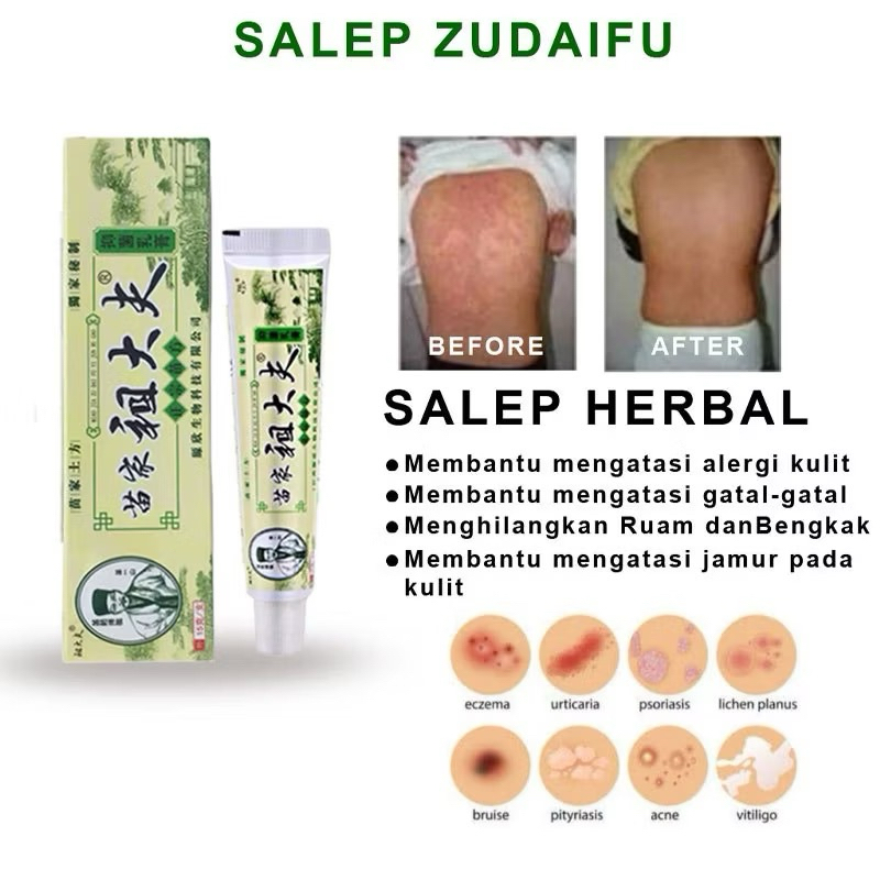 SALEP GATEL ZUDAIFU CREAM CHINA ZUDAIFU CREAM ALERGI
