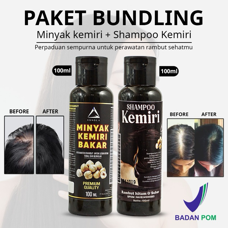 Paket 2in1 Shampoo & Minyak Kemiri Penumbuh Rambut Cepat Penghilang Uban Dan Rontok 100ml - BPOM