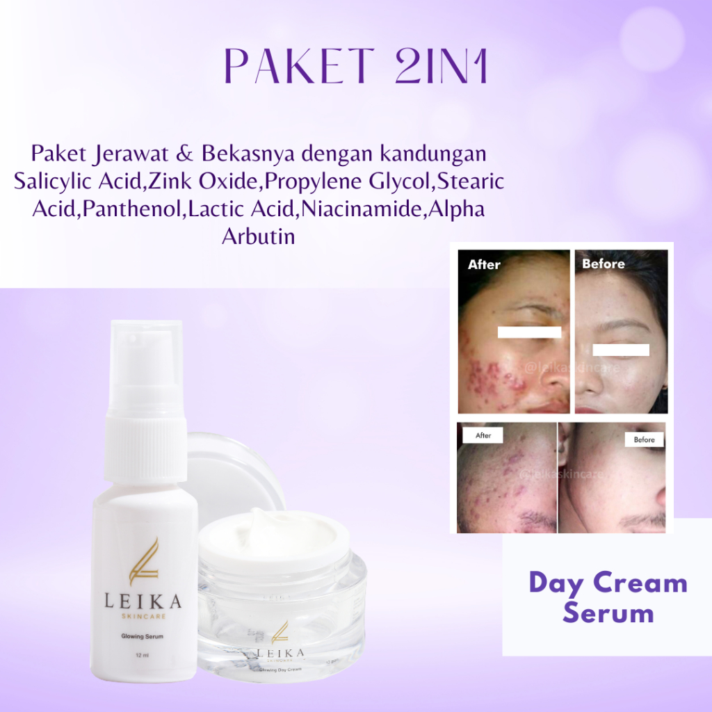 [DAY CREAM & SERUM] Penghilang Jerawat Dan Bekas Jerawat Bpom Penghilang Jerawat Dan Bruntusan Pengh