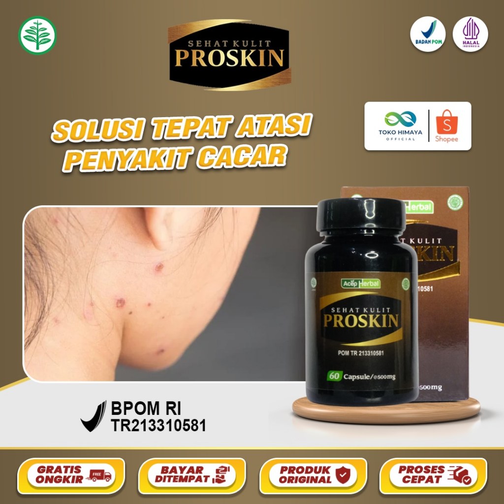 PROSKIN Obat Penghilang Cacar Gatal Cacar Air Cacar Api Cacar Monyet Cacar Ular Kulit Gatal Ruam