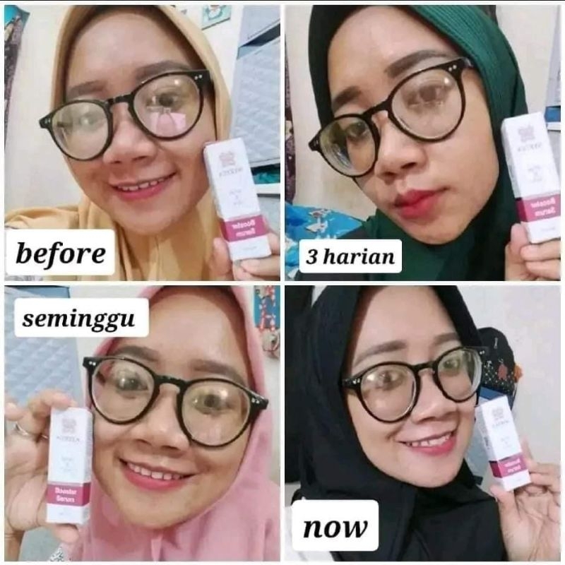serum boster nyrtea