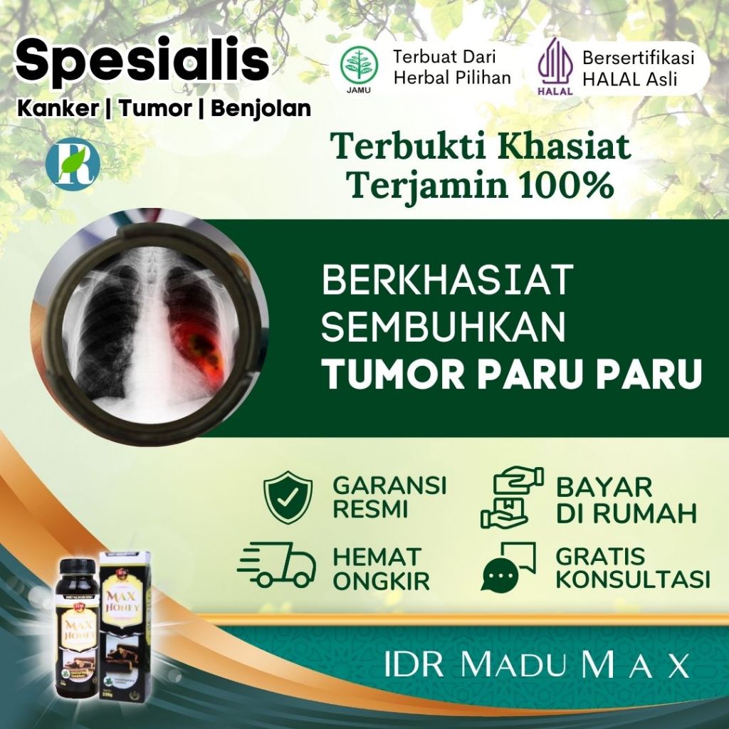 Obat Tumor Paru Paru - IDR Madu Max - Testimoni Terbukti 100%